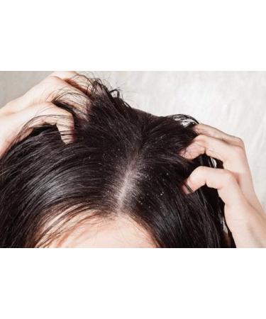 postQuam Professional Dandruff Control Complex - 12 Vials for All Hair Types | Daily Use Beauty & Personal Care | Eliminate Dandruff Effectively - Buy Online on GoSupps.com