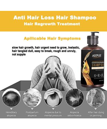 Natural Hair Loss Treatment Shampoo - Promotes Hair Growth & Prevents Loss - Old Ginger Formula - 10OZ - Buy Online on GoSupps.com