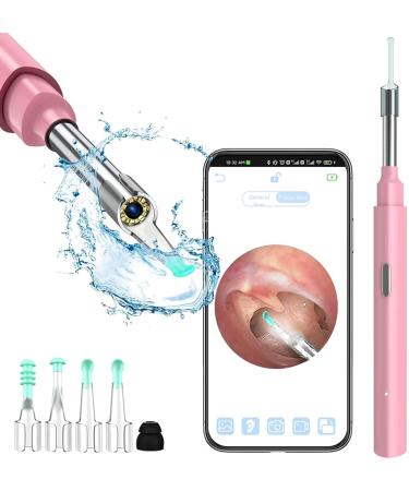 QDCFY OTOSKOK Endoscopic camera tool for removing ear wax wireless otoscope with LED light for iPhone iPad and Android smartphone (black) greenen