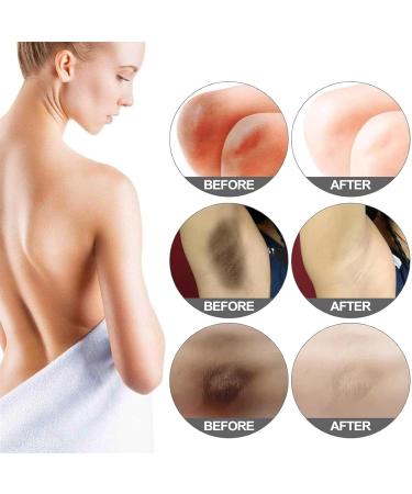 Cr me clairage sous les bras claircisse et hydrate la cr me sous les bras absorbant rapidement Formule douce sans blanchie pour un ton lisse et m m (1Pcs) - Buy Online on GoSupps.com