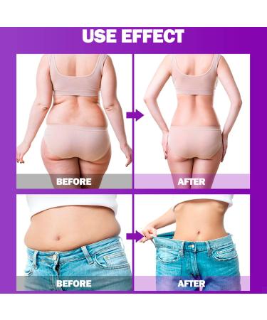 AICHUN BEAUTY Slimming Body Essential Oil Capsules - Anti-Cellulite Fat Burning 400mg (90 pcs) - International Shipping Available - Buy Online on GoSupps.com