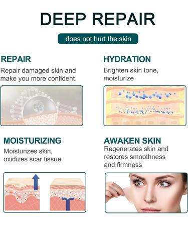 Professional Silicone Scar Tape - Soft Scar Sheets for Acne, Keloid, Burns - 1.6 x 120 Roll - Buy Online on GoSupps.com