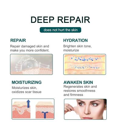 Silicone Scar Sheets & Tape - Medical Scar Removal Strips for Surgery Keloid C-Section Acne | Reusable | 1.6 x 120 Roll - Buy Online on GoSupps.com