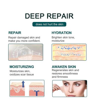 ZODENIS Silicone Scar Tape - Reusable Professional Scar Removal Sheets - 12 Month Supply - Buy Online on GoSupps.com