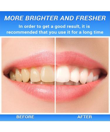 Niacinamide Whitening Toothpaste for Sensitive Teeth & Gums | Natural Stain Removal & Fresh Breath - Buy Online on GoSupps.com