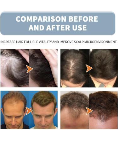 EXQST Nourishing Root Scrub Purifying Scrub for Hair Regrowth Scalp Scrub for Hair Growth Nourishes Hair and Reduces Hair Loss - Buy Online on GoSupps.com