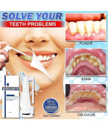 Calculusfree Dissolving Dental Spray - Powerful Dental Calculus Remover & Mouth Refreshing Spray (3 PCs) | Intensive Stain Removal for Clean Teeth - Buy Online on GoSupps.com