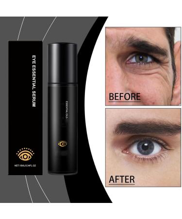 VKaoess Retinol Eye Serum for Men Reduce Light Circles Under Eye Serum with Hydrating Essence Stick Eye Cream for Dark Circles and Puffy Eyes for Men and Women 10 ml 8 Bottles - Buy Online on GoSupps.com