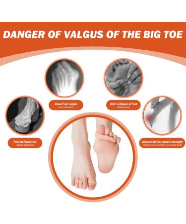 3 Pairs Silicone Toe Separators Elastic Toe Separators for Pedicure Breathable Bunion Corrector for Women Men Toe Separators - Buy Online on GoSupps.com