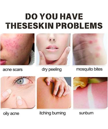 Jasmine Rice Face Wash Gentle Acne Face Wash Pure Rice Cleansing Foam Refreshing Face Wash Pore Deep Cleansing Foam Daily Gentle Cleanser Hydrating Cleanser for Radiant Smooth Exfoliating - Buy Online on GoSupps.com