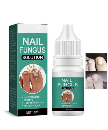 Fungal Nail Treatment for Toenail Extra Strong 10ML Nail Fungus Solution for Toenail Toenail Fungus Treatment Nail Repair for Fingernails Toenails Strengthen Renew Damaged Broken Nails 2Pcs