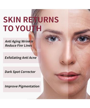 AHA 30% + BHA 2% Peeling Solution - Anti-Acne Serum & Chemical Peel for Face | BHA Liquid Exfoliant for Blemishes & Wrinkles - 1 Floz - Buy Online on GoSupps.com