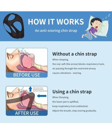 Adjustable Anti-Snoring Chin Strap with Breathable Design - Nose Clip Included - For Men and Women - Buy Online on GoSupps.com