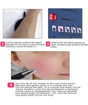 Generous Spider Vein Removal Device | High-Frequency Facial & Leg Treatment | Home Salon Beauty Equipment - Buy Online on GoSupps.com