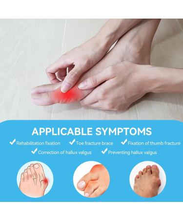 Agate Toe Clasp for Hallux Valgus Correction - Injured Toe Support & Straightener - Men's & Women's Toe Protection - Buy Online on GoSupps.com
