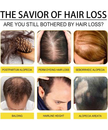 Black Seed Oil Black Seed Oil for Hair & Face Black Seed Hair Growth Serum Hair Serum for Dry Damaged Hair Face & Hair Anti Aging Face Serum Natural Hair Growth Serum Hair Growth & Smooth Your Skin - Buy Online on GoSupps.com