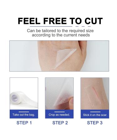 Professional Grade Silicone Scar Removal Sheets - 1.6 x 120 3M - For C-Section Surgery, Burn, Acne, Stretch Marks - Works on Old & New Scars - Reusable - Buy Online on GoSupps.com