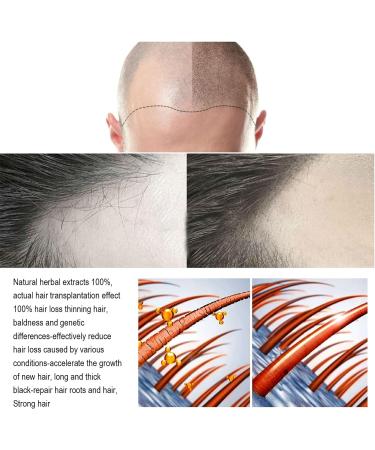 Abonda 3PCS Hair Growth Serums Hair Serums for Hair Growth Helps Stop Hair Loss Keep Hair Regrowth Hair Loss Treatments for Men and Women - Buy Online on GoSupps.com