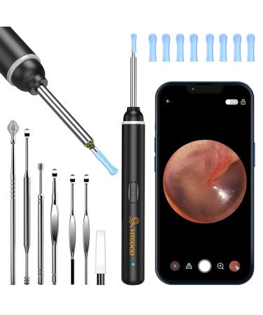 VITCOCO Ear Wax Removal Tool  1920P HD Ear Cleaner with 6 LED Lights  3mm Mini Visual Ear Camera  Ear Cleaning Kit for iPhone  iPad  Android Black