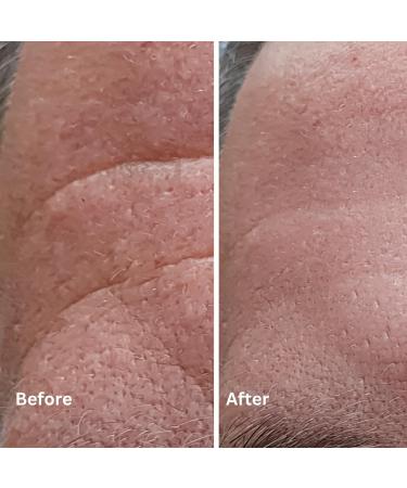 S rum puissant antioxydant - avec 300% plus d'acide ferulique et de vitamines C et E. PLUS PUISSANT que tout le reste dos pour vous faire conomiser travail et argent ! Bouteille 30ml. - Buy Online on GoSupps.com