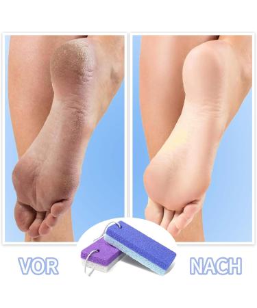 Buy Alethron Pumice Stone - Double-Sided Foot Care Set (2 Pieces) for Effective Skin Peeling & Smoothing | Durable Corn Remover for Feet & Hands - Buy Online on GoSupps.com