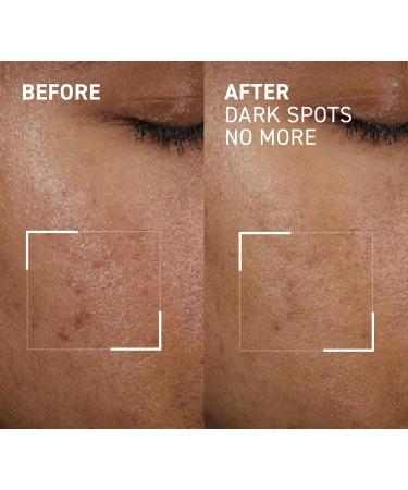 Dr. Brandt Bright This Way Dark Spots No More - Reduce Pigment Spots 0.5 fl oz | Shop Internationally - Buy Online on GoSupps.com
