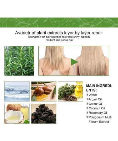 Shelure Hair Growth Oil Shelure Rosemary Hair Oil Organic Shelure Hair Regrowth Treatment Oil Hair Regrowth Extract Oil Get Luscious Locks With Shelure Hair Regrowth Oil - Buy Online on GoSupps.com