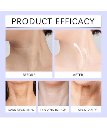 QASKLBN New Age Brilliance Neck Firming Cream Collagen Lifting Neck Cream Contains A Super Trio And Seven Powerful Nutrients Suitable For All Skin Types - Buy Online on GoSupps.com