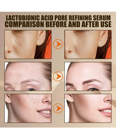 Lactobionic Acid Pore Refining Serum - Shrink Pores Remove Blackheads Reduce Fine Lines & Wrinkles - Anti-Aging Facial Essence 30ml for All Skin Types - Buy Online on GoSupps.com