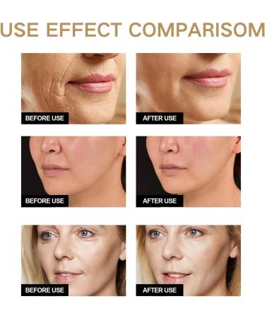 Dark Spot Correcting Glow Serum - Niacinamide Serum - Hyaluronic Acid Serum for Face - Skin Care - Face Serum for Women - Deeply Hydrating Serum - Face Serum for Anti-Ageing and Wrinkle Shrink Pores - Buy Online on GoSupps.com