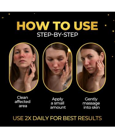 Anume Naturals Goldenseal Ointment Herbal Skin Balm with Golden Seal MCT Oil & Olive Oil for Dry or Irritated Skin 100% Natural Plant-Based Vegan & Cruelty-Free - Buy Online on GoSupps.com