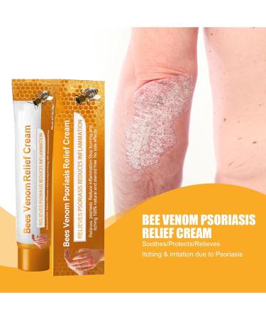 KOAHDE Psoriasis Professional Treatment Cream Bee Venom Psoriasis Treatment Cream Bee Venom Professional Treatment Cream Bee Venom Treatment Cream Bee Venom Topical Cream Bee Psoriasis Repair Cream - Buy Online on GoSupps.com