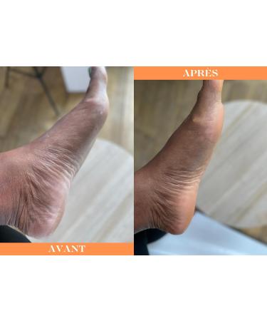 Foot care cream in ROLL-ON - Buy Online on GoSupps.com