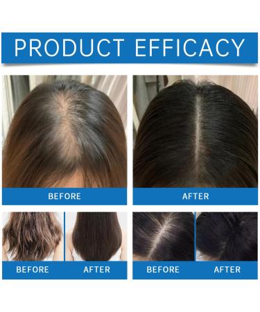 EONFAVE Gentle cream for facial hair removal painless longlasting hair removal cream - Buy Online on GoSupps.com