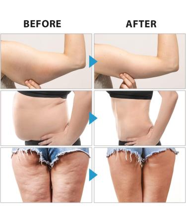 Kaotic Magic Tape - Von Magic Tape for Stomach (Black 5cm x 5m) - International Shipping Available - Buy Online on GoSupps.com