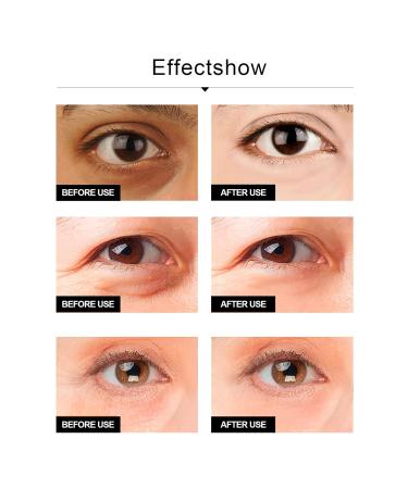 GROEE Eyes Wrinkle Cream - Reduce Swelling, Improve Eyesight & Non-Pungent Formula - Buy Online on GoSupps.com