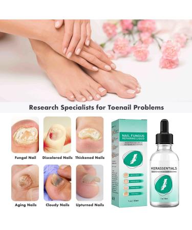 3Pcs Kerassentials Toenail Treatment Kit - Extra Strength for Repairing Damaged Nails - Buy Online on GoSupps.com