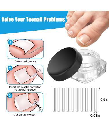 Ingrown Toenail Removal Kit - Professional Pedicure Tool Set for Seniors, Includes Clippers, Corrector Patch, and Strips for Thick Toe Nails - Pain Relief Treatment - Buy Online on GoSupps.com