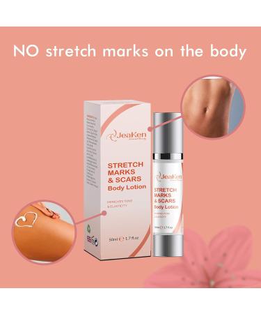STRETCH MARK REMOVER - SCARS BODY LOTION - Firming Body Lotion Infused with Essential Oils and Extracts to Improve the Appearance of Scars Stretch Marks and Uneven Skin Tone - 50 ml - Buy Online on GoSupps.com