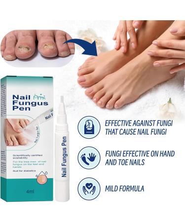 Fungal Nail Serum Pen with Tea Tree Oil and Aloe - Extra Strong Treatment for Toenails and Fingernails - Improve Damaged Nails - 1PCS - Buy Online on GoSupps.com