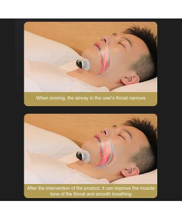 Smart Throat Snore Device for Night - Reduce Stress and Anxiety, Mini Snore Machine for Relief - Buy Online on GoSupps.com