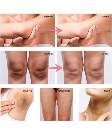 3Pcs 50ml Skin Lightening Cream Fading Dark Spots and Brightening Skin Body Bleaching Cream For Intimate Area Underarm Knees Elbows - Buy Online on GoSupps.com