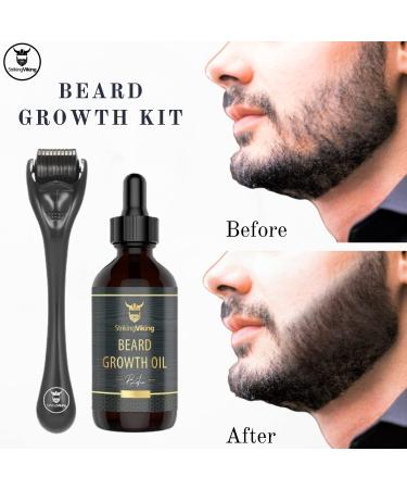 Striking Viking Beard Growth Kit: Beard Roller & Biotin Oil Set for Thickening and Conditioning Beards - Sandalwood Scented - Men's Facial Hair Growth Essentials - Buy Online on GoSupps.com