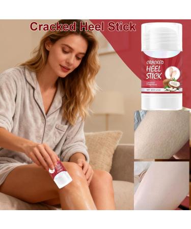  Jingmiger Nourishing Foot Balm | 40g Roll-On Skin Cream Stick Nourishing Cream for Cracked Feet For Men Teenagers Adults Seniors Home Dorm Travel Elbows Knees - Buy Online on GoSupps.com