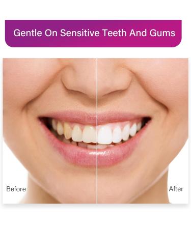 Purple Toothpaste Teeth Whitener | Advanced Stain Remover & Color Corrector for a Bright Smile - Gentle on Enamel - Buy Online on GoSupps.com