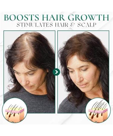  Vinxan HariPure Regrowth Centella Purifying Scrub Gentle Scalp Exfoliator Sea Salt Exfoliating Shampoo (1 Piece) - Buy Online on GoSupps.com