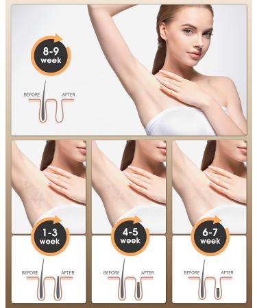 LZSTOP IPL Hair Removal Device | Permanent Painless Removal | 999,999 Flashes | At-Home Use for Facial, Lips, Arms, Legs, Bikini, Back - Black - Buy Online on GoSupps.com