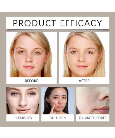 Nettoyant Visage Hydratant Doux Aux Acides Amin s - Nettoyant Doux Hydratant Nettoyant Quotidien For Tous Types De Peau(2PCS) - Buy Online on GoSupps.com