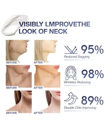 SADOWAY Neck Cream for Tightening & Firming | Hydrating Neck & Face Cream for Men & Women - Best Anti-Aging Solution - Buy Online on GoSupps.com