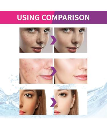 Urea Cream for Dark Spots Urea Cream with Vitamin E Dark Spot Reducing Creams Softening Face Cream for Dark Spots Reduce Wrinkles Even Out Skin Tone - Buy Online on GoSupps.com